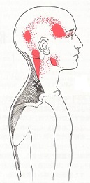 1-6僧帽筋1.jpg